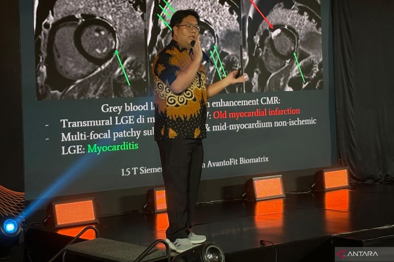 Radiolog sebut terjadi disparitas MRI di berbagai provinsi Indonesia