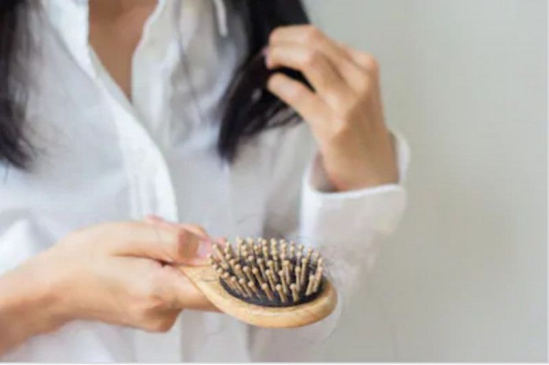 Konsumsi minuman manis dan alkohol pengaruhi kesehatan rambut