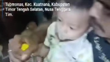 Ayah di NTT Cekoki Miras ke Bayi 11 Bulan, Alasannya Demi Lucu-lucuan