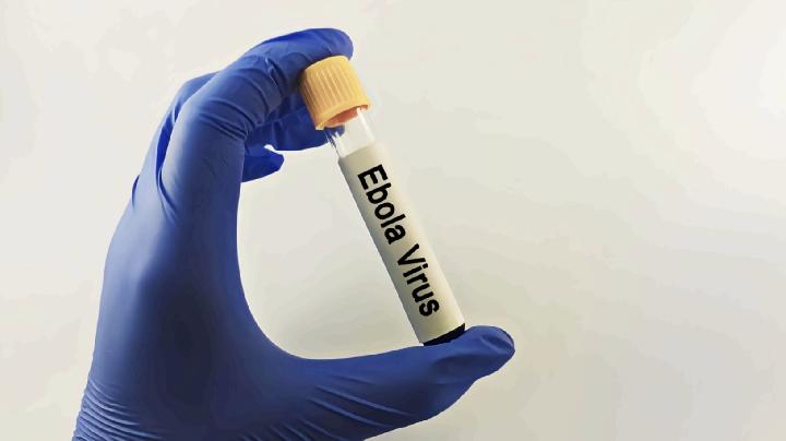 Status Darurat Global Ebola, Kemenkes Ingatkan Warga Waspada